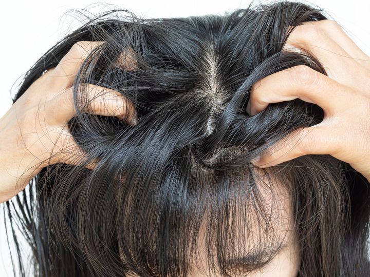 Scalp Glycation: How Your Skin’s "Sugar Crust" is Literally Stifling New Hair Growth