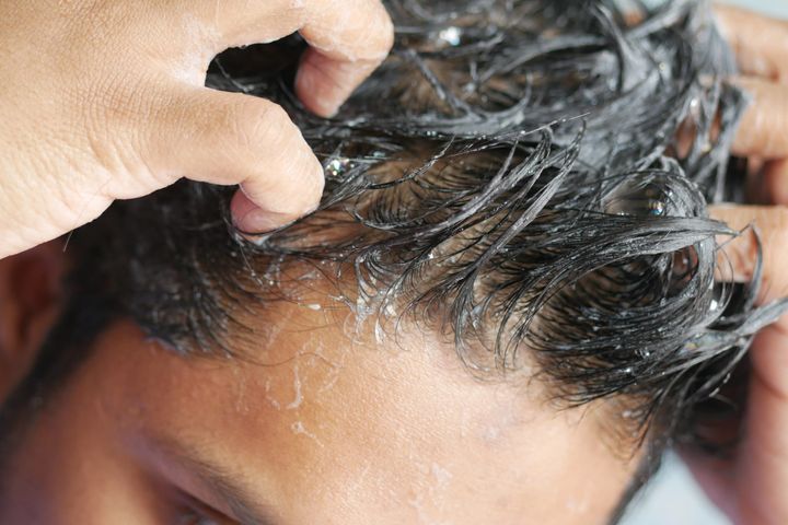 The Acid Mantle Audit: How to Tell if Your 'Clarifying' Shampoo has Destroyed Your Scalp’s Natural Defense
