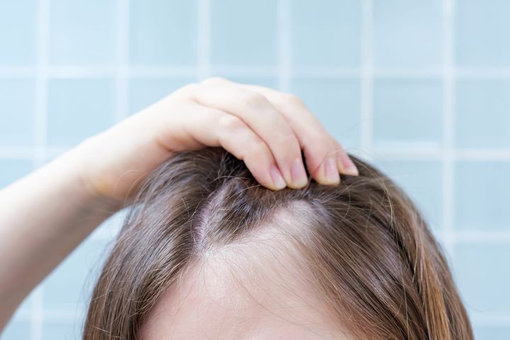 The Oxygen Deficit: How Dormant Follicles Suffocate Beneath Tight Scalp Tissue