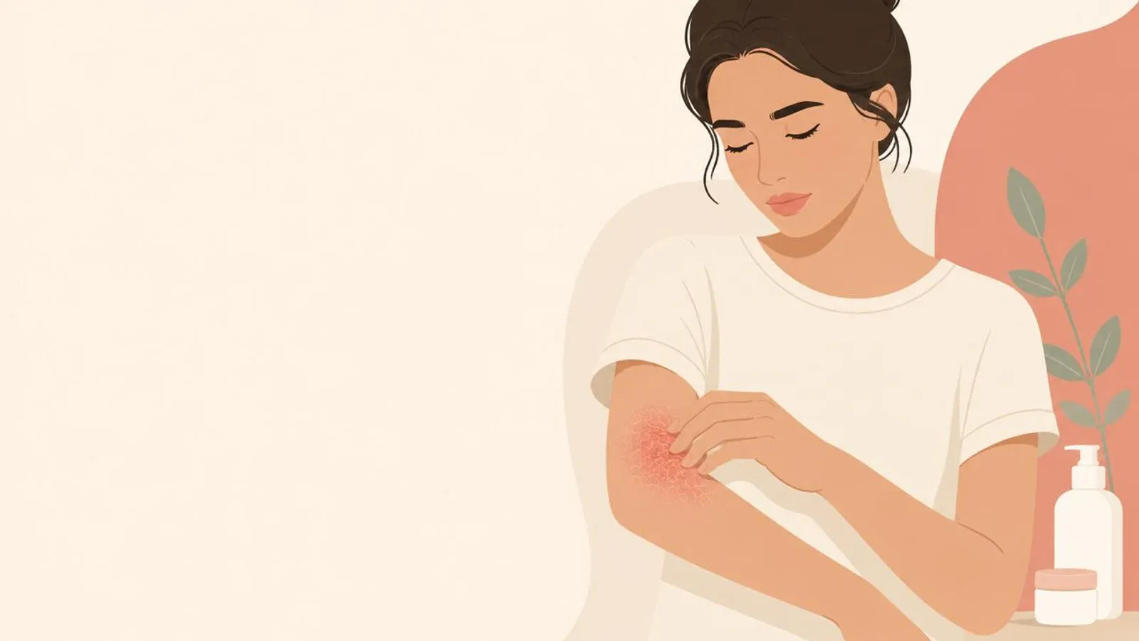 Illustration of a woman touching a red, irritated-looking patch on her elbow beside two unbranded skincare containers.