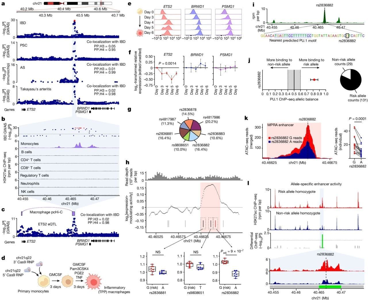A new genetic cause for Inflammatory Bowel Disease has been discovered