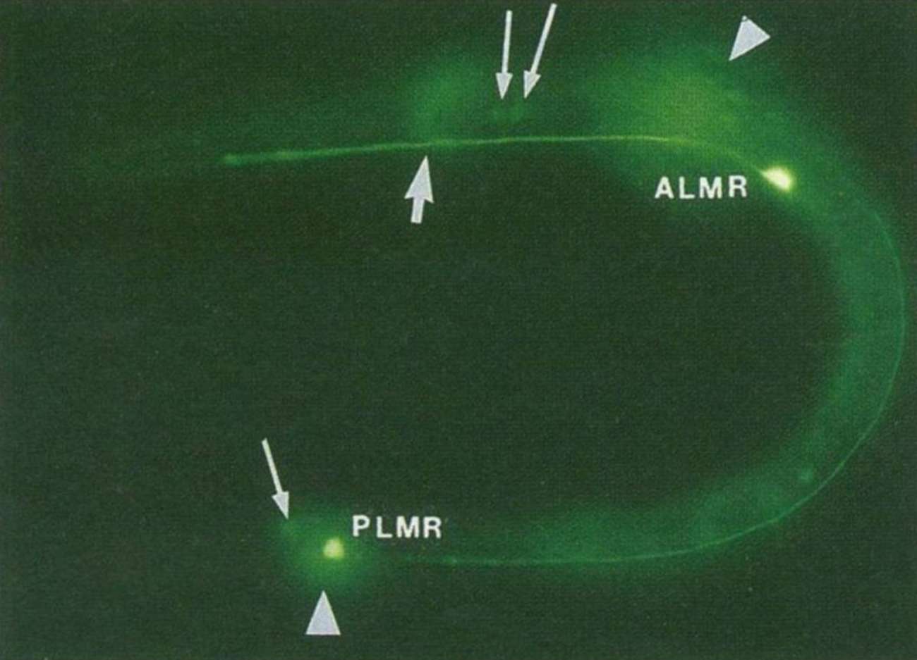 Jelly fish proteins started brightening up microscopy in 1994