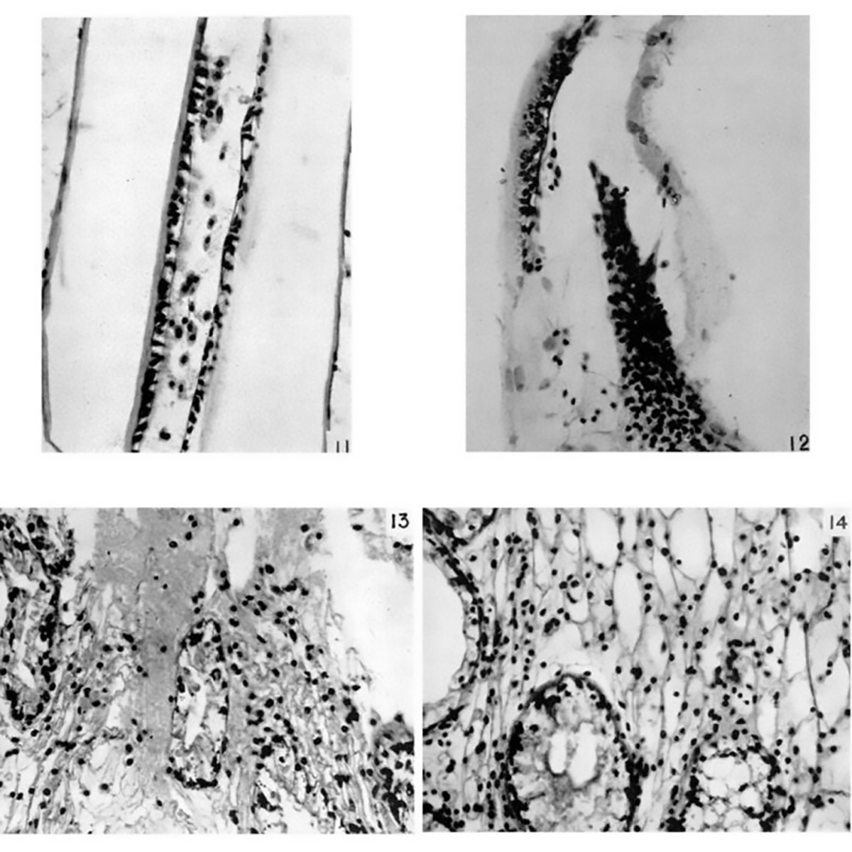 Horseshoe crab blood to the rescue!