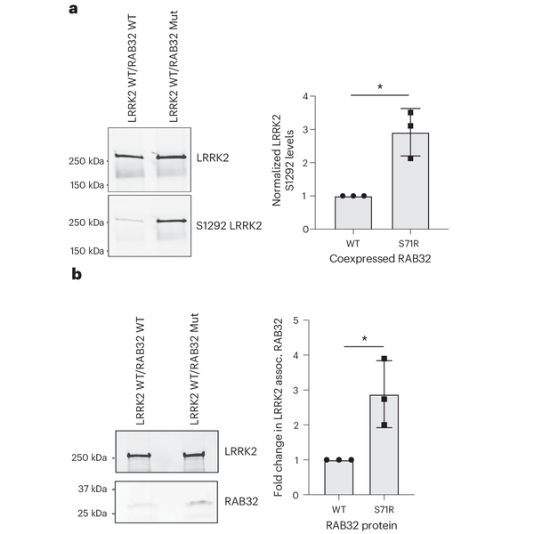 Parkinson's Disease gets a new risk factor