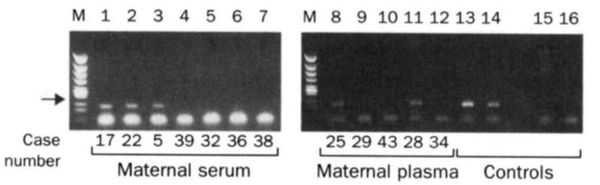 Non-invasive prenatal testing is a big business. Here's how it got its start.