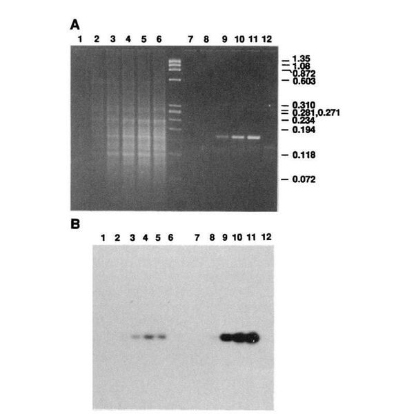 PCR has a more interesting history than you might have been told