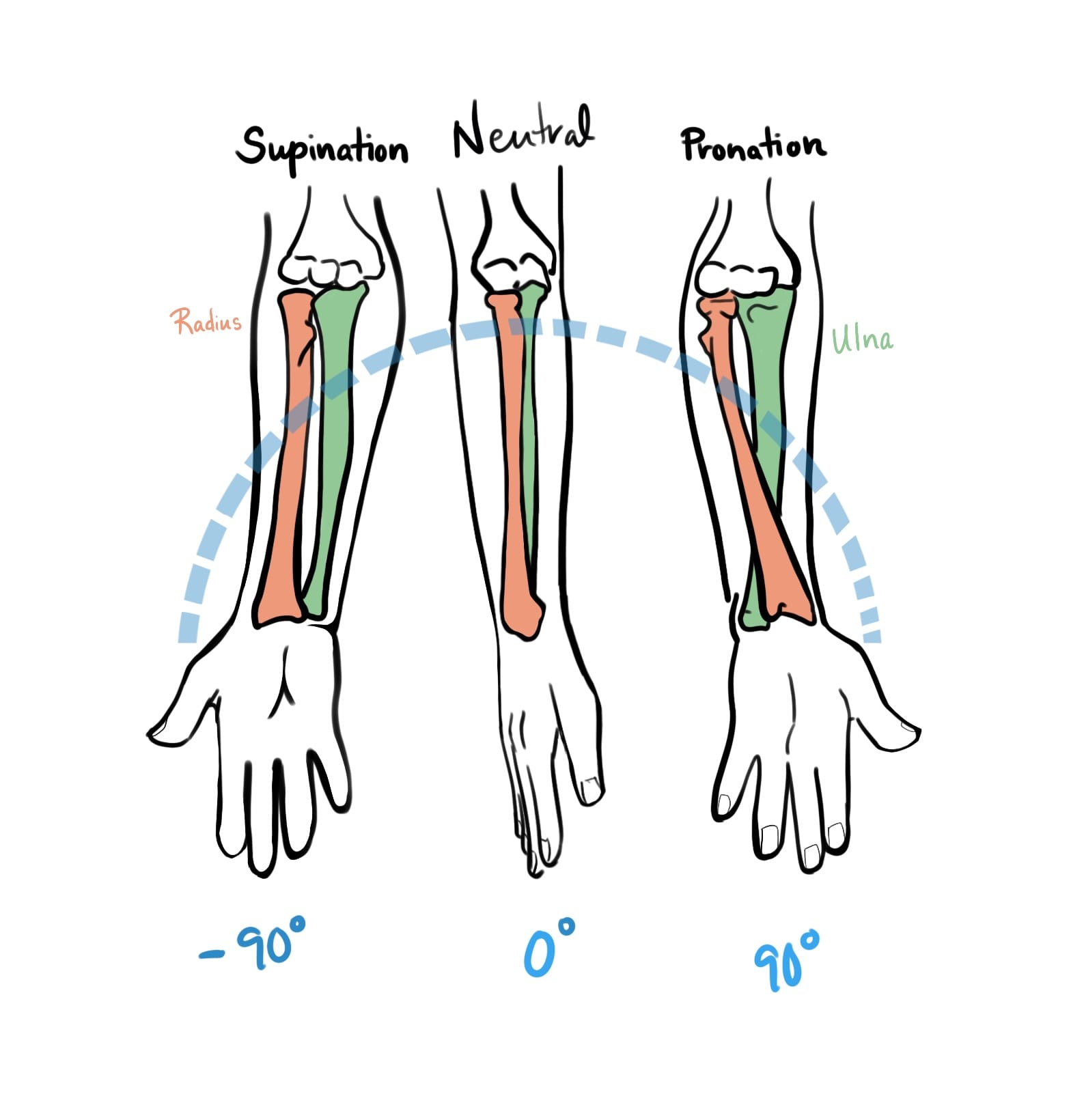 An illustration of supination, neutral and pronation positions for the hand. Supination is with the palm up at -90 degrees. Neutral is with the thumb up at 0 degrees. Pronation is 90 degrees palm down. The Radius and Ulna are highlighted in pink and green, with the bones overlapping in the pronated position.