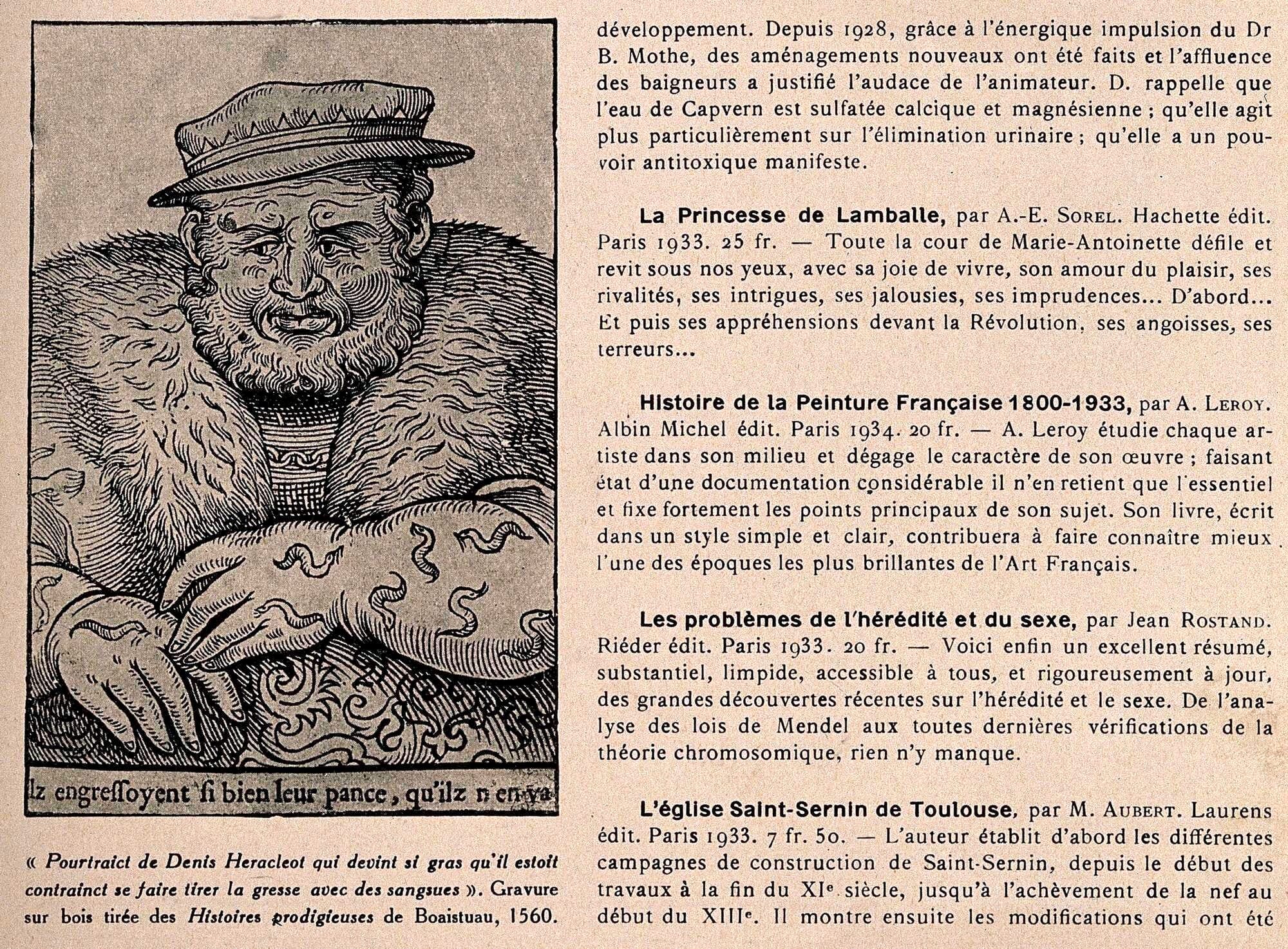 Dionysius of Heraclea, an obese man applying leeches to his arms in order to lose weight. Reproduction of a woodcut.