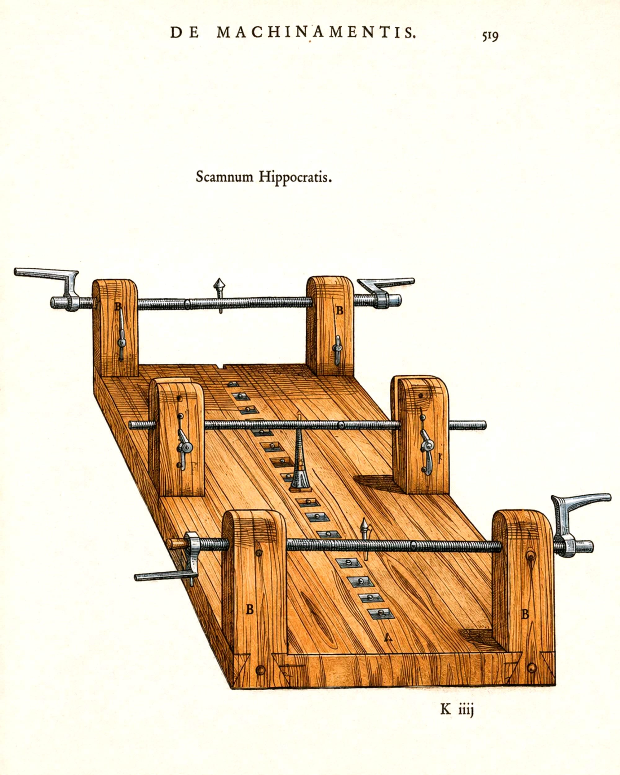 Luxation table of Oribasius. A specialized device designed for reducing dislocated joints, particularly in the spine and extremities, using mechanical traction. 