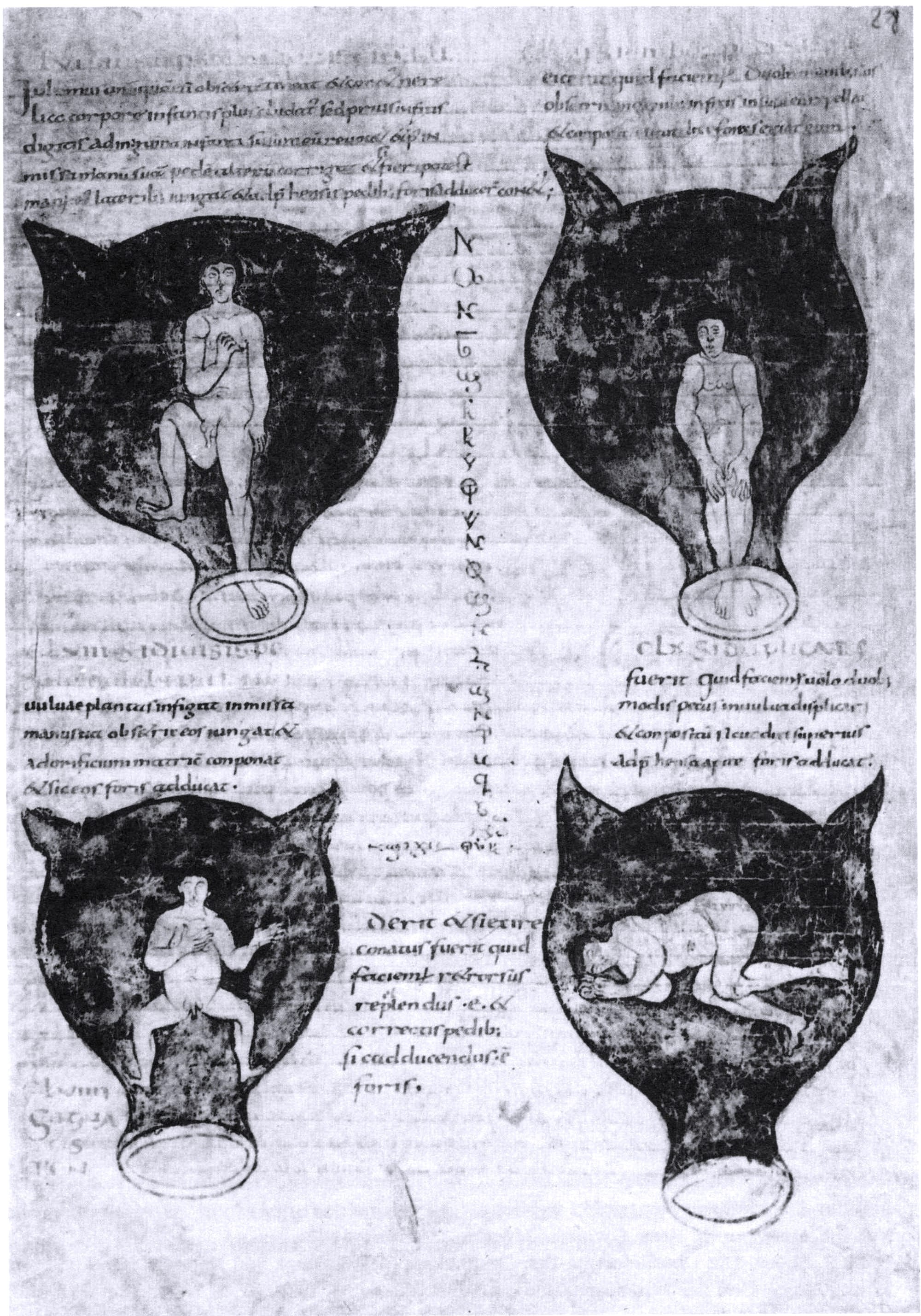 Soranus of Ephesus, Gynaecology, in a Latin version of Late Antiquity: positions of the embryo in the uterus. The illustrations in this medieval manuscript are probably based on drawings by Soranus. Brussels, Bibliothèque Royale