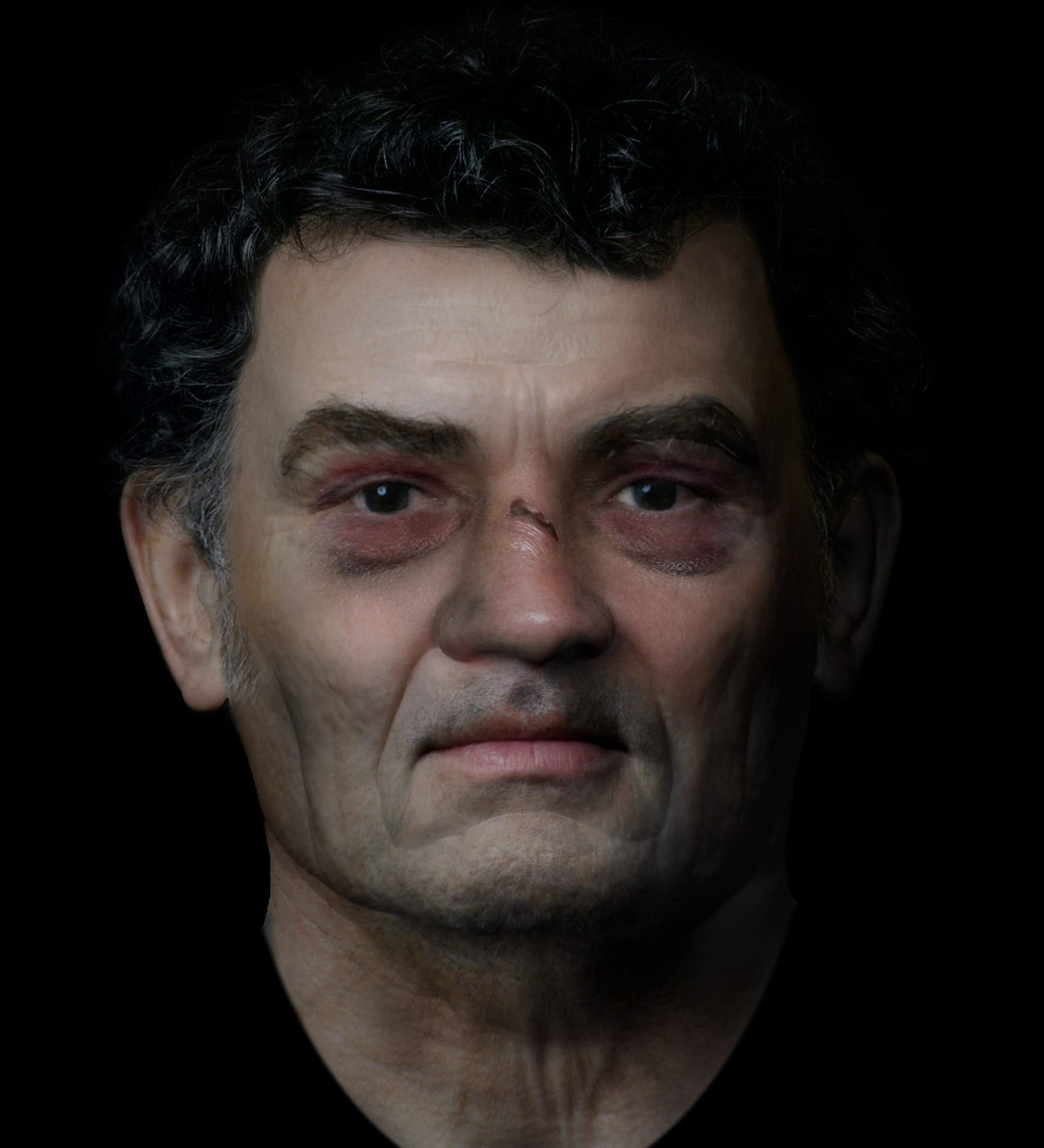 Alternative digital reconstruction of the Inveresk man with short facial hair and bruising shown around the eyes.