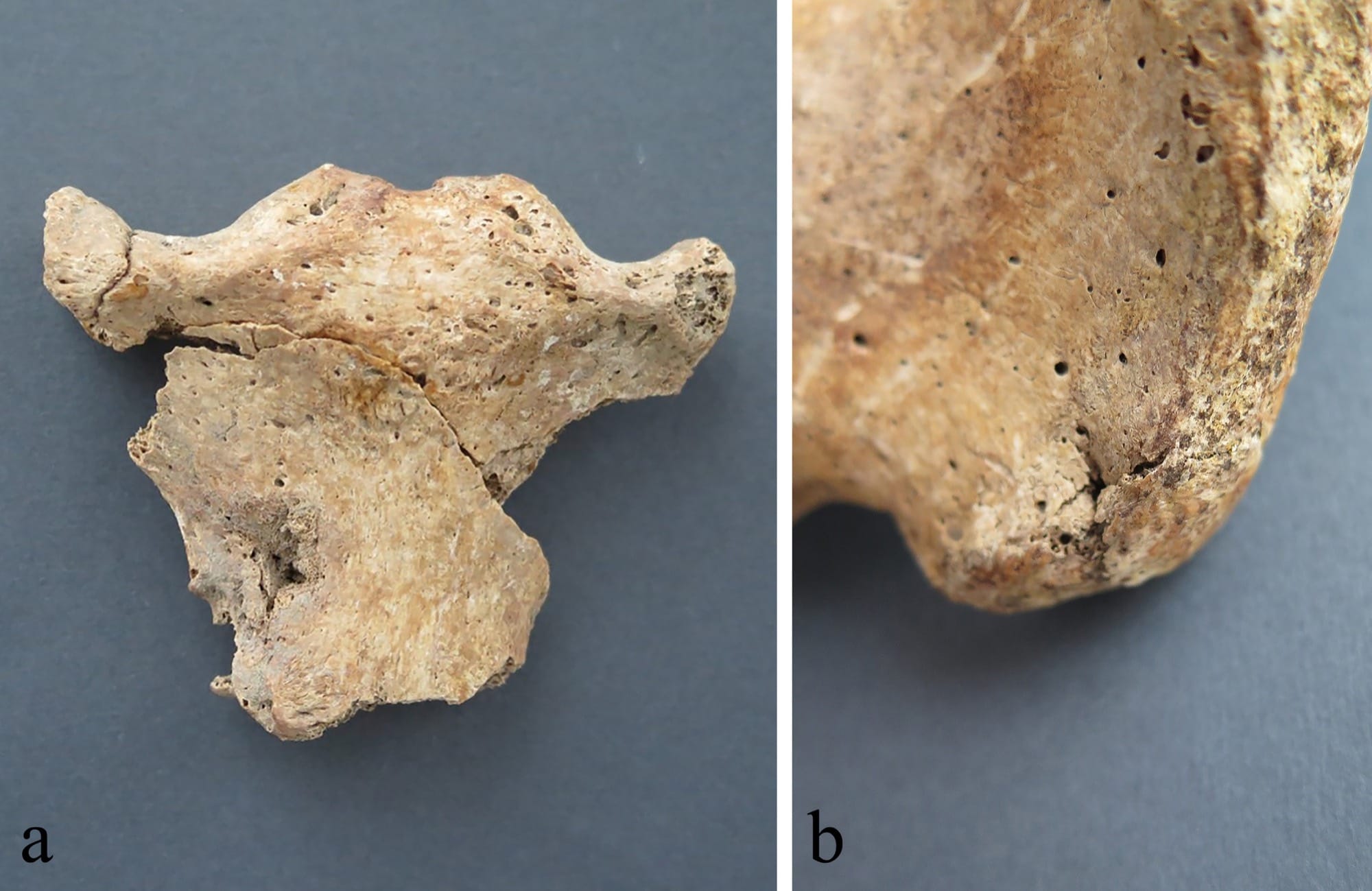 Two archaeological bone photographs: a puncture on the front of SK 4’s upper breastbone at left and a puncture on the back of SK 5’s right pelvic bone at right.