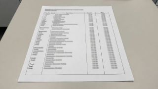 Couronnes dentaires : ce que la position de la dent change à votre remboursement