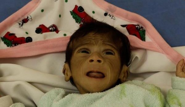 Gaza : au bout du bout de la faim, par Barthélemy Greluchon