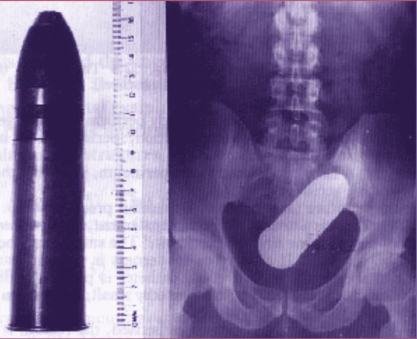 Chronique de la folie ordinaire de la France contemporaine