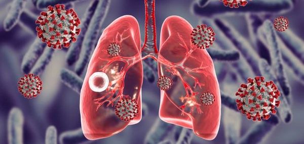 Une étude précise les comorbidités qui aggravent le Covid