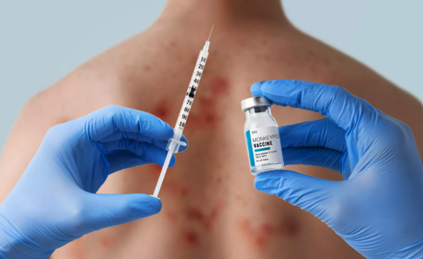 L’OMS ne confirme ni infirme le lien entre injection COVID et Mpox