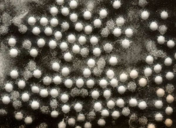 Vers une épidémie de polio en Ukraine ?