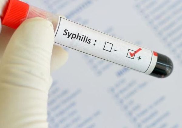 Aux USA, les cas de syphilis ont atteint leur plus haut niveau depuis 1950