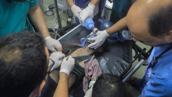 Meyssan : « Un tiers des amputations sans anesthésie à Gaza se fait sur des enfants »