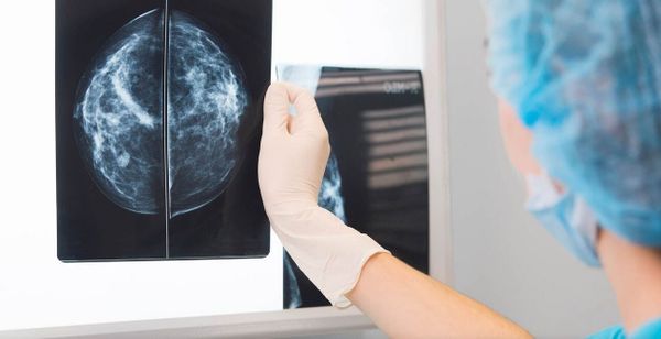 Le COVID est peut-être la clé pour vaincre le cancer