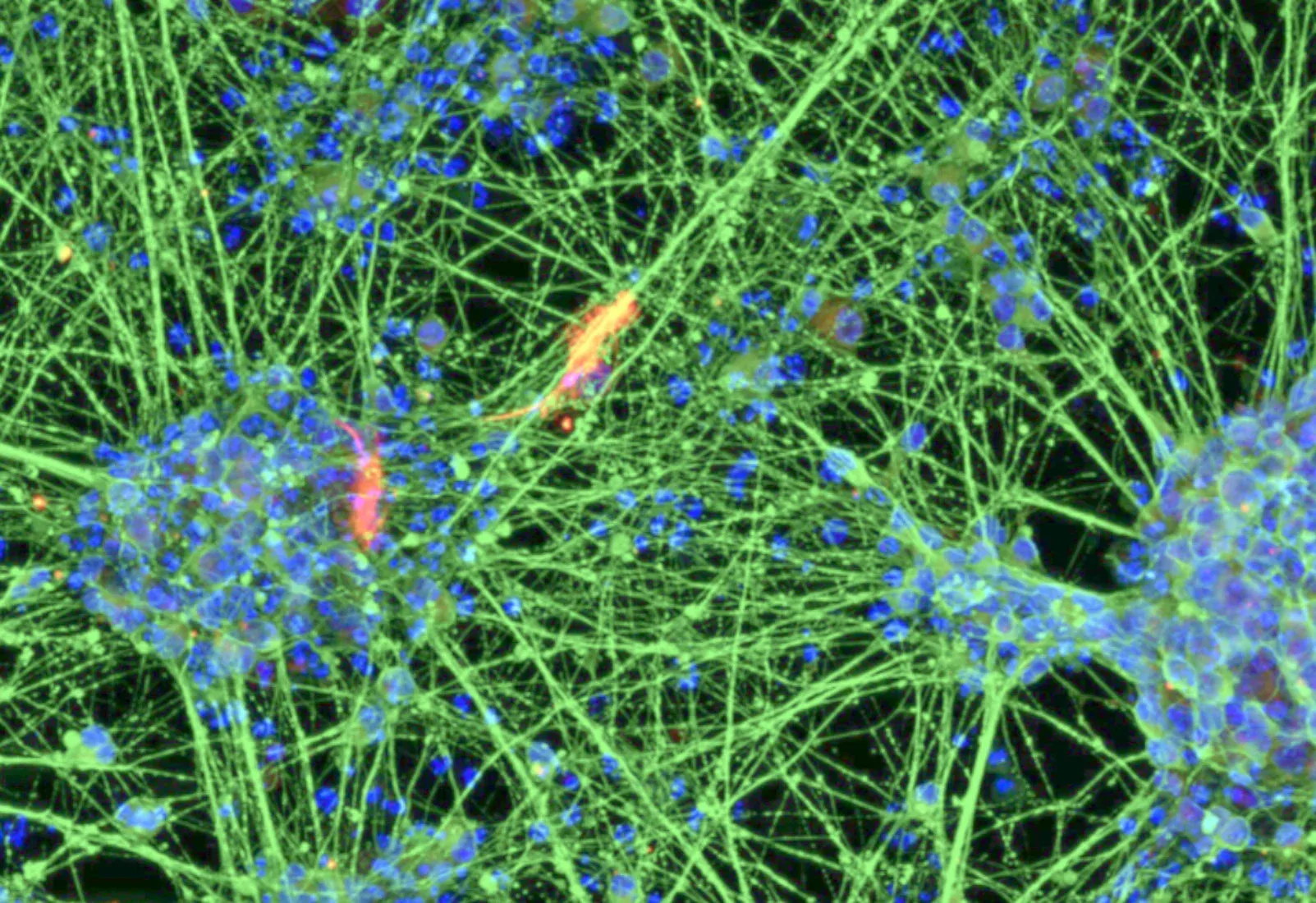 Fluorescence micrograph of neurons generated from blood-derived neural stem cells, showing branching green fibers and blue-stained nuclei.