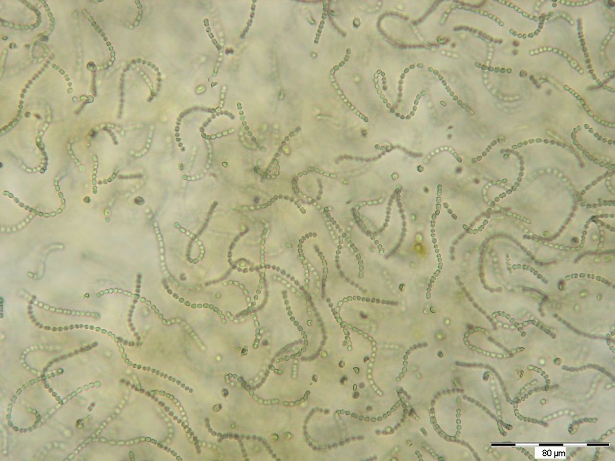 Blaualgen unter dem Mikroskop