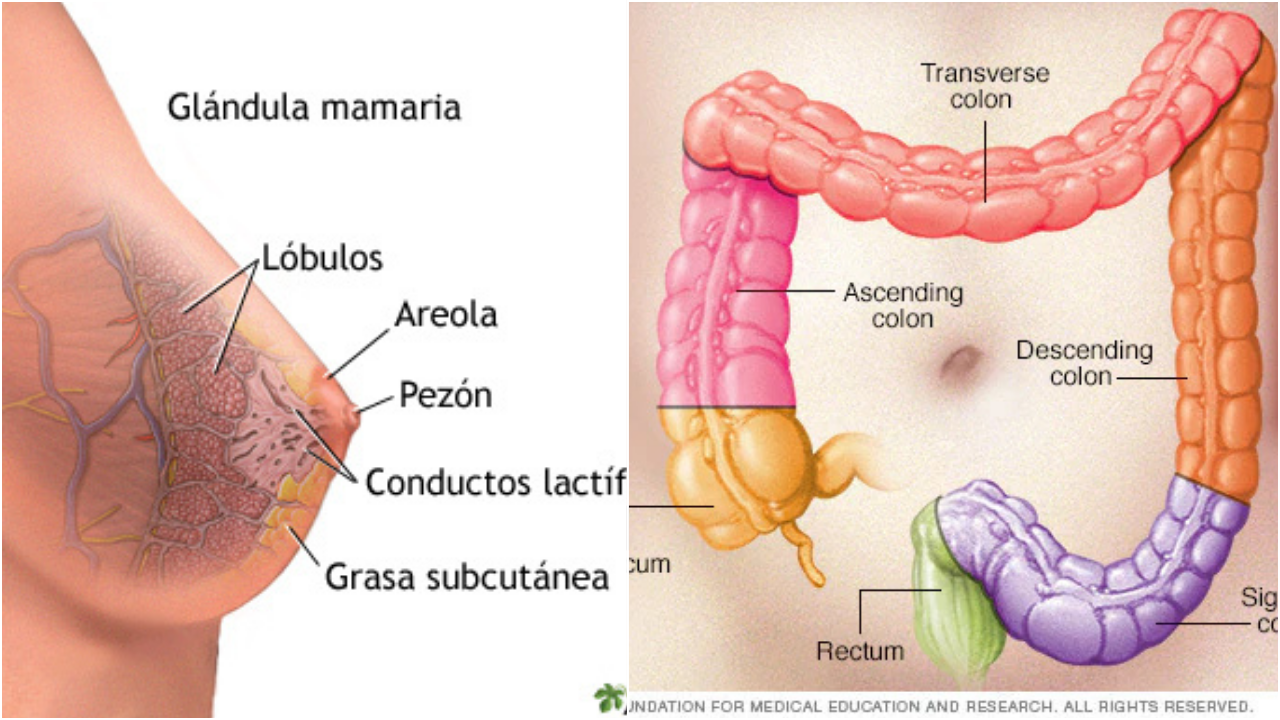 Cáncer de mama y de colón.