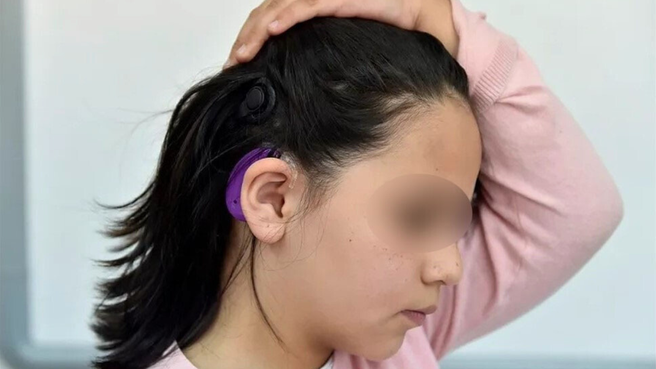 Niños mexiquenses con sordera severa podrán recuperar el sentido del oído