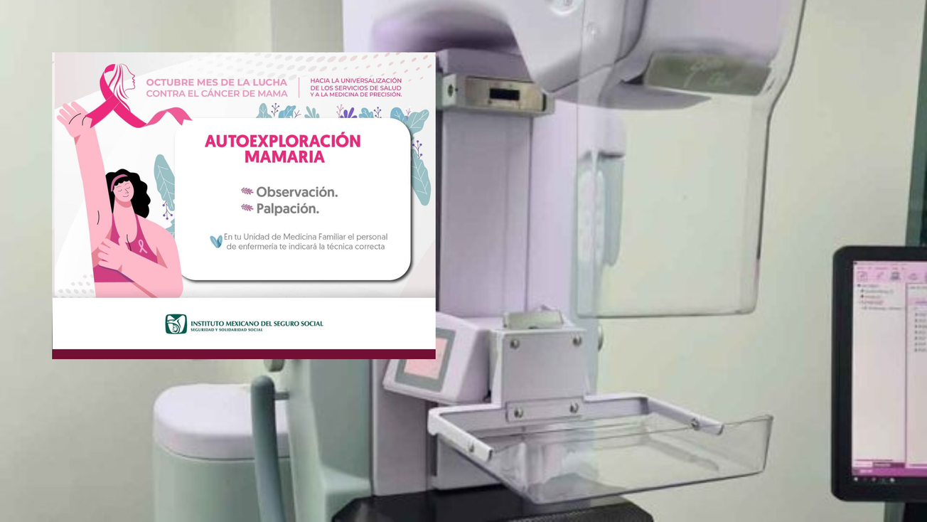 IMSS Edomex promueve detección oportuna de cáncer de mama en hombres