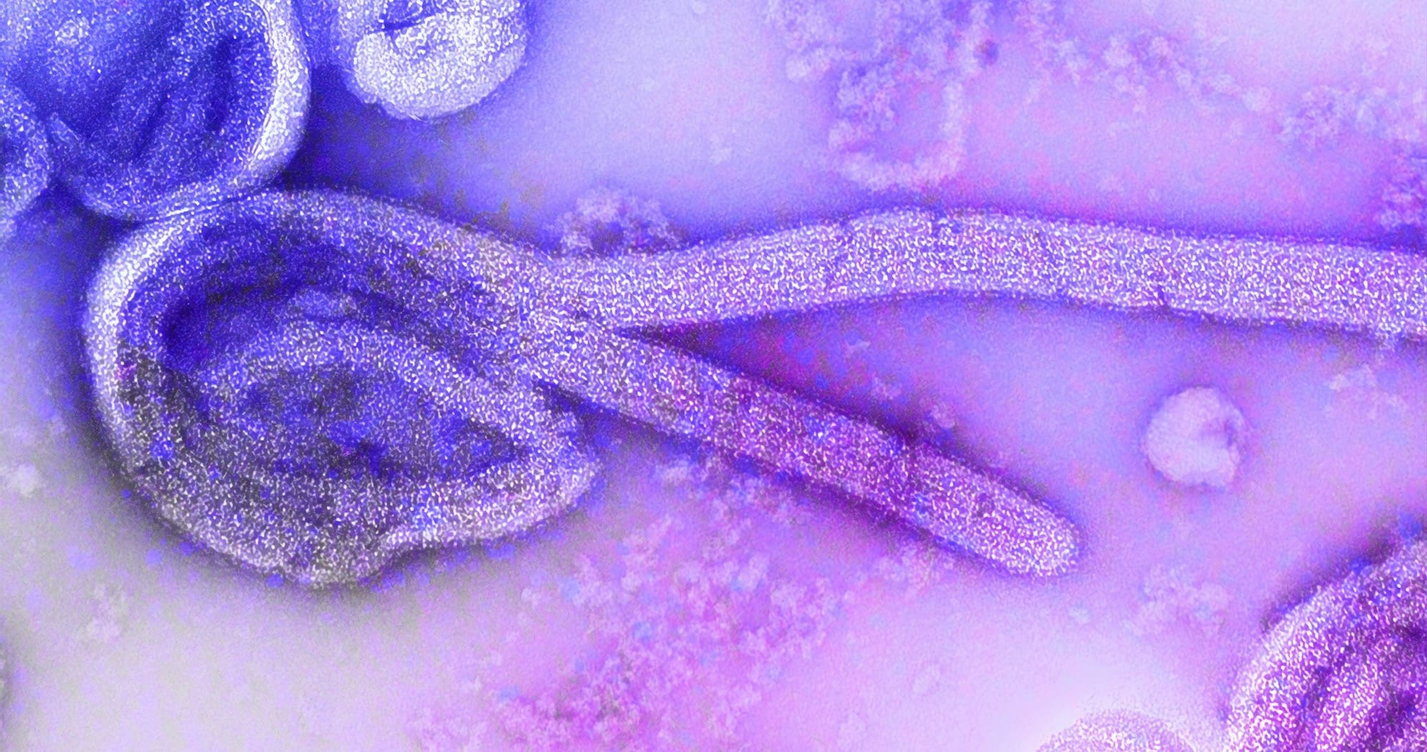 Colorized microscope image of purple, thread-shaped Ebola virus particles