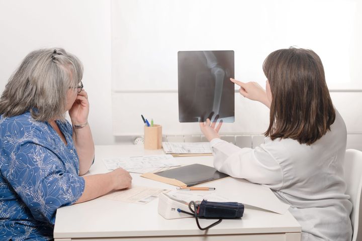 ¿Qué es la osteoporosis y cómo afecta a tus huesos?