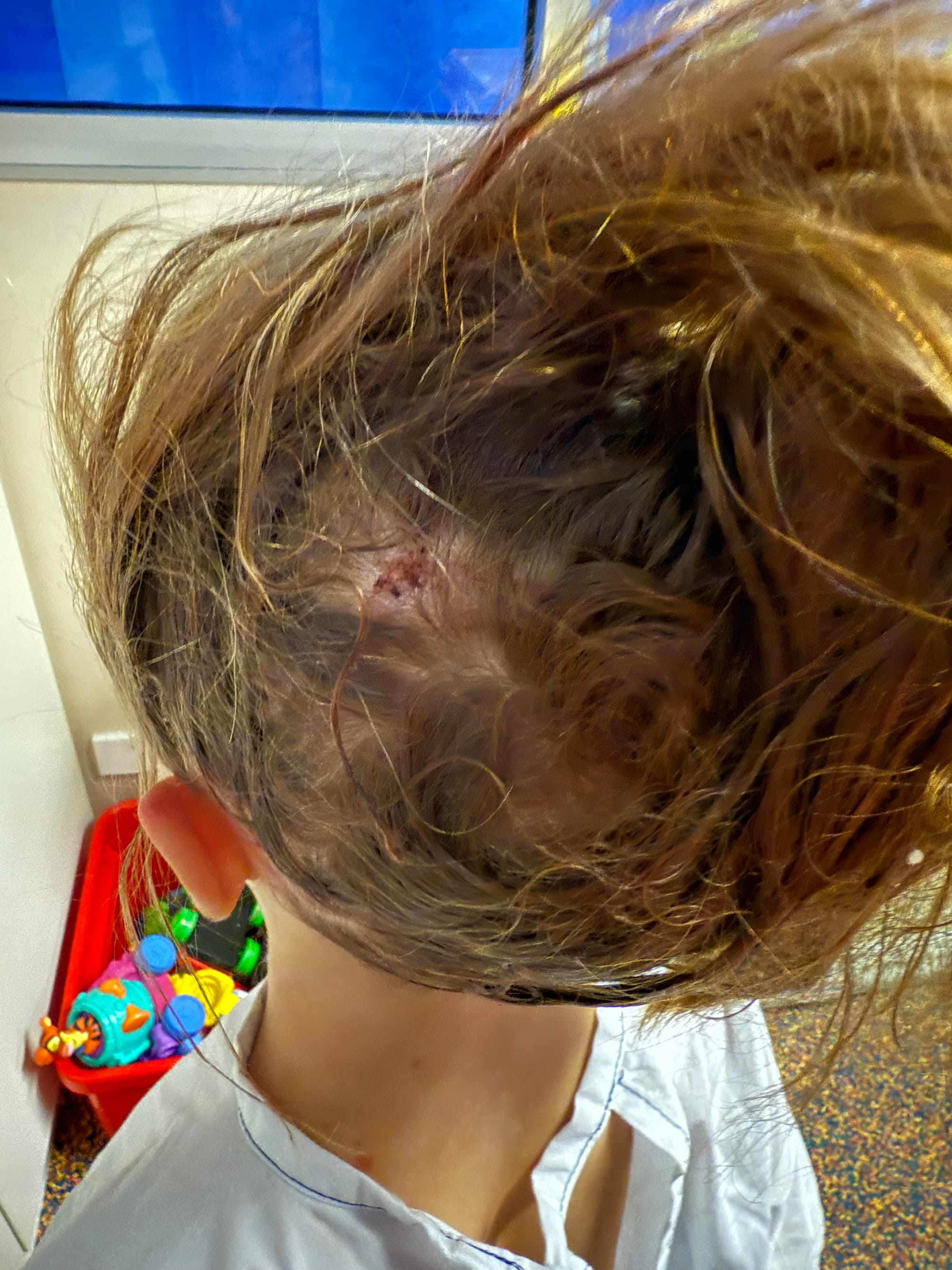 Child the victim of latest dog park attack