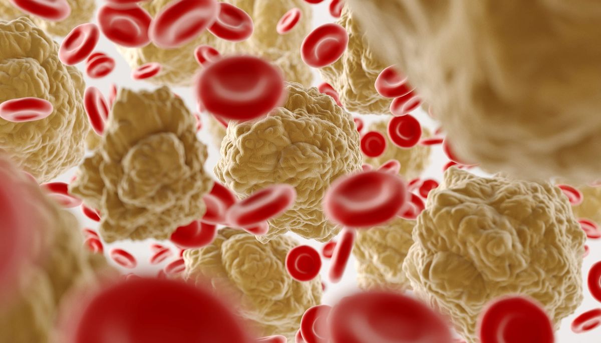The Cholesterol Mistakes That Confuse Millions of Adults