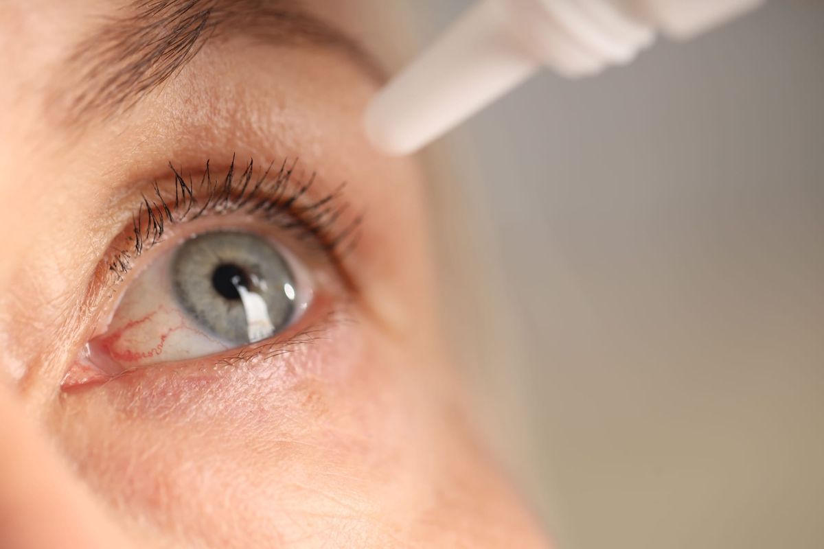 Why Dry Eyes Are More Than Just an Annoyance