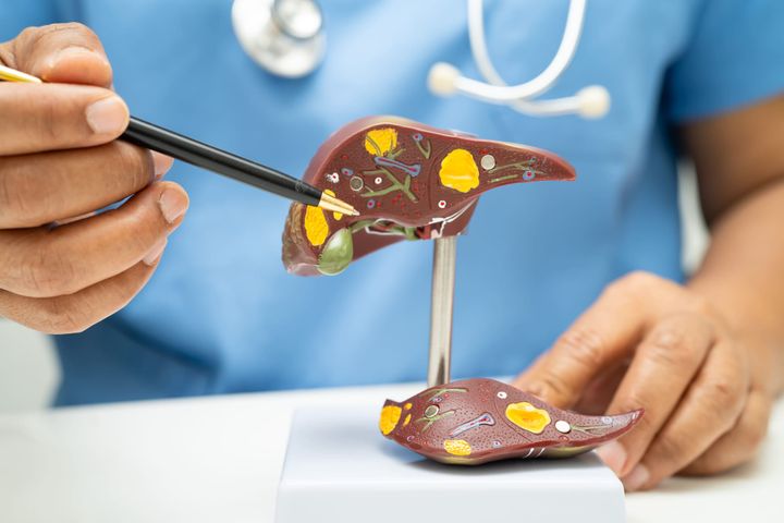 The Silent Warning Signs of Fatty Liver Disease