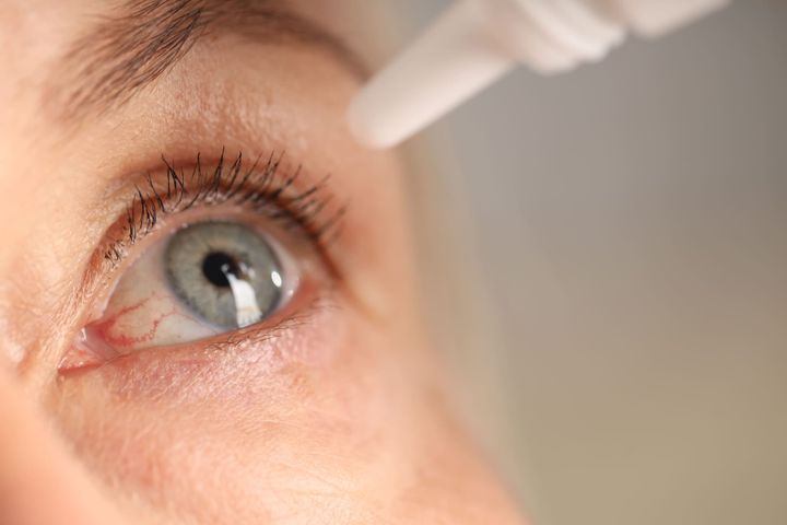 Why Dry Eyes Are More Than Just an Annoyance