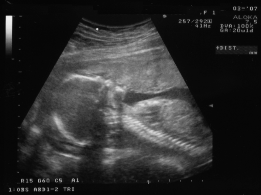 vida humana, chatgpt, inteligencia artificial, ai, ia