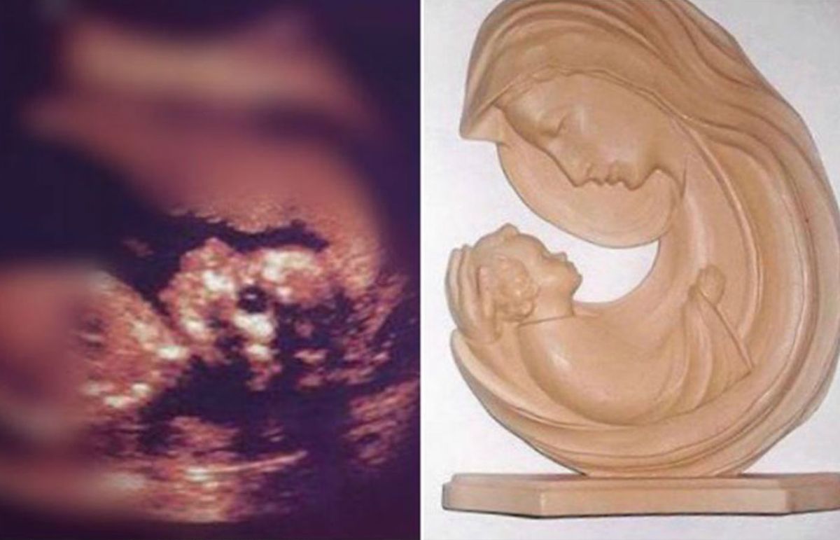 Imagen de la Virgen María aparece protegiendo al bebé en una ecografía
