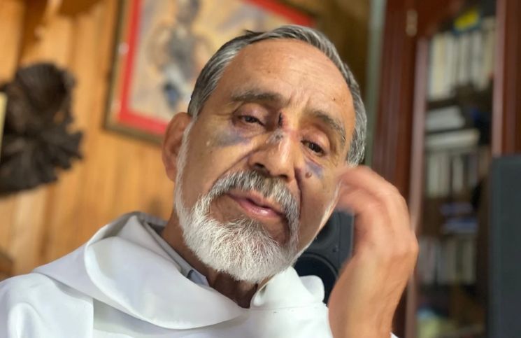 "Me destrozó la cara": Sicario ataca a sacerdote y lo golpea brutalmente