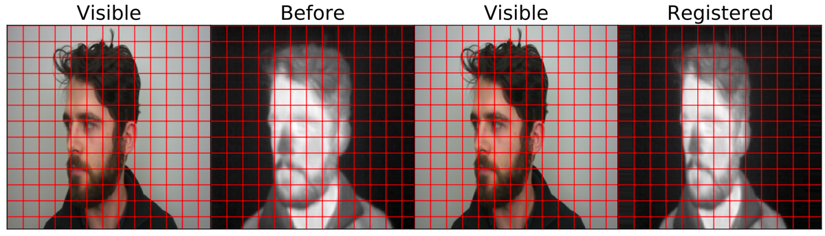 An Overview of Image Registration