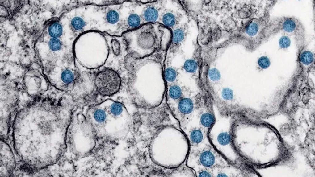 越封城，西方国家死亡率越高