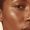 How Long Does Hyperpigmentation Actually Take to Fade?