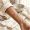 Subtle friction-related darkening on a woman's inner arm in soft natural light.