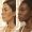 Two women with different patterns of facial pigmentation in natural light