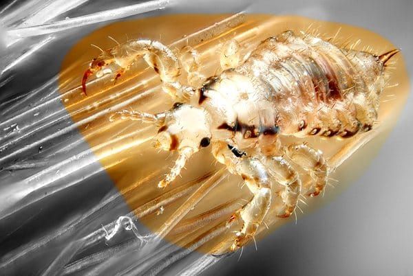 head-lice