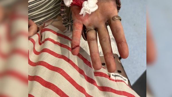 血迹斑斑：女孩在奥克兰火车站遭群殴