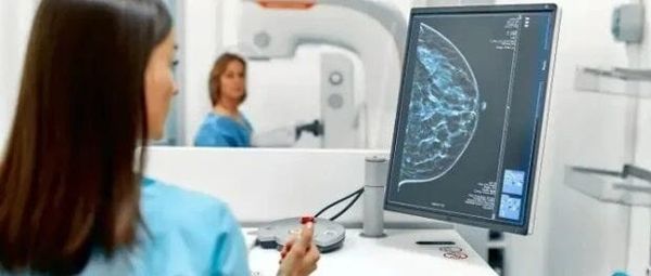 新西兰乳腺筛查计划为符合条件女性提供免费检查及社区支持