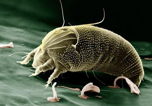 dust-mite-allergy