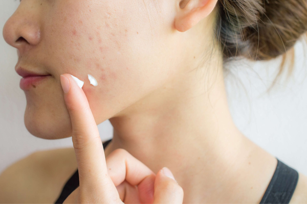 What Does Tretinoin Do? Understand this magic Retinoid to transform your skin.